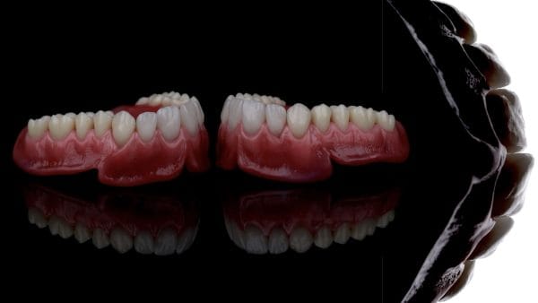 Excellence in Implant-Supported Overdentures - Image 2