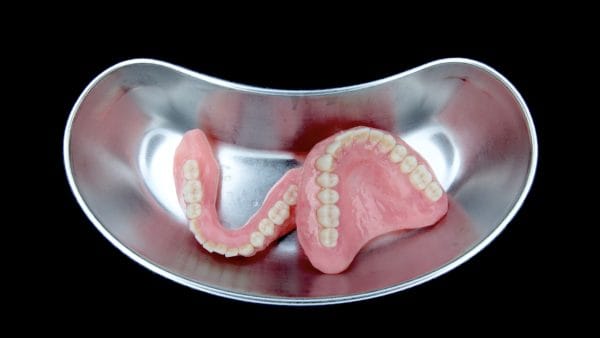 Excellence in Implant-Supported Overdentures - Image 8
