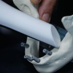 Digital Implantology and Workflow Track