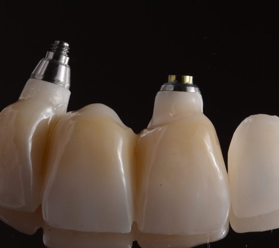 Dental Implant Prosthetics Course