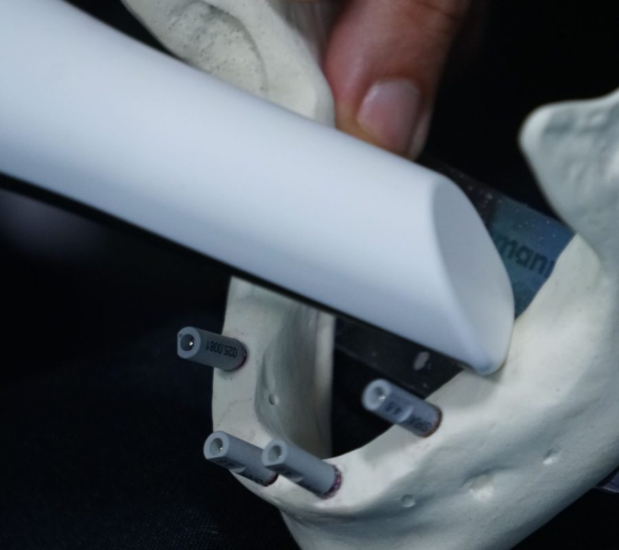 Digital Implantology and Workflow Track