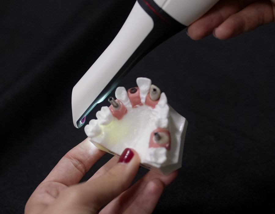 Implant restorative track